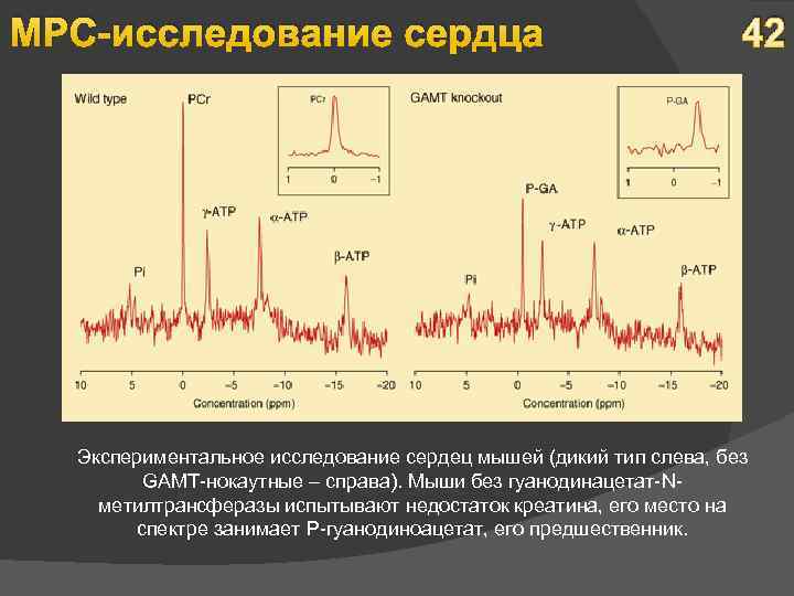 МРС-исследование сердца 42 Экспериментальное исследование сердец мышей (дикий тип слева, без GAMT-нокаутные – справа).