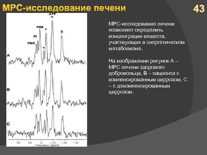 МРС-исследование печени позволяет определить концентрации веществ, участвующих в энергетическом метаболизме. На изображении рисунок А