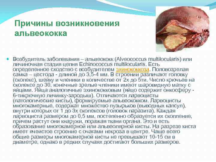 Причины возникновения альвеококка Возбудитель заболевания – альвеококк (Alveococcus multilocularis) или личиночная стадия цепня Echinococcus