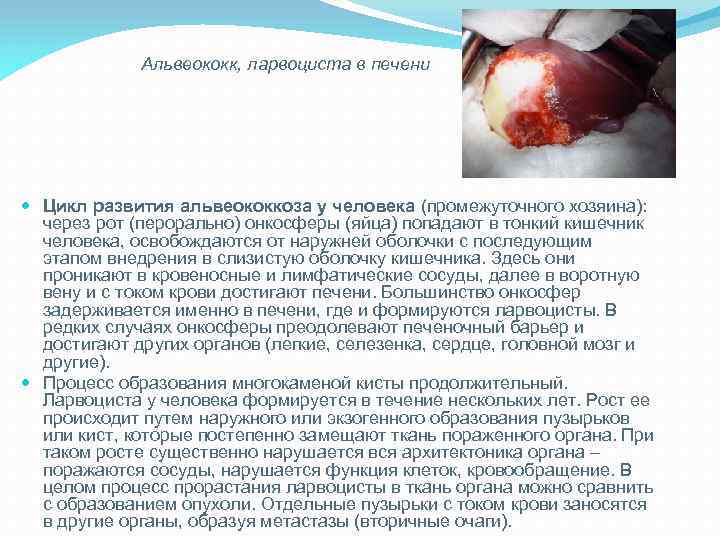 Альвеококк, ларвоциста в печени Цикл развития альвеококкоза у человека (промежуточного хозяина): через рот (перорально)