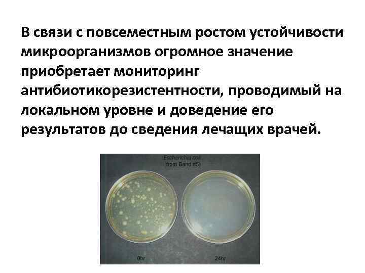 В связи с повсеместным ростом устойчивости микроорганизмов огромное значение приобретает мониторинг антибиотикорезистентности, проводимый на