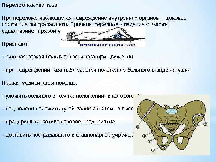 Перелом костей таза При переломе наблюдается повреждение внутренних органов и шоковое состояние пострадавшего. Причины