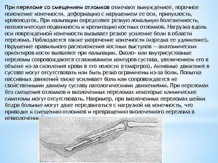 При переломе со смещением отломков отмечают вынужденное, порочное положение конечности, деформацию с нарушением ее