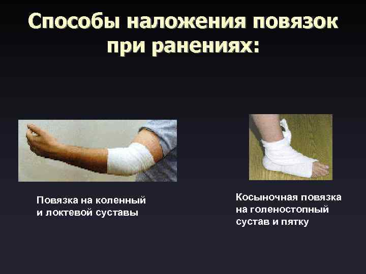 Способы наложения повязок при ранениях: Повязка на коленный и локтевой суставы Косыночная повязка на
