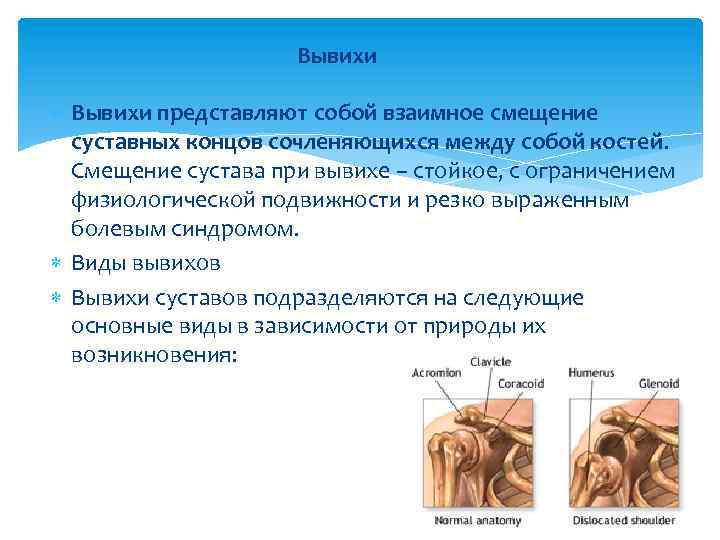 Вывихи представляют собой взаимное смещение суставных концов сочленяющихся между собой костей. Смещение сустава при