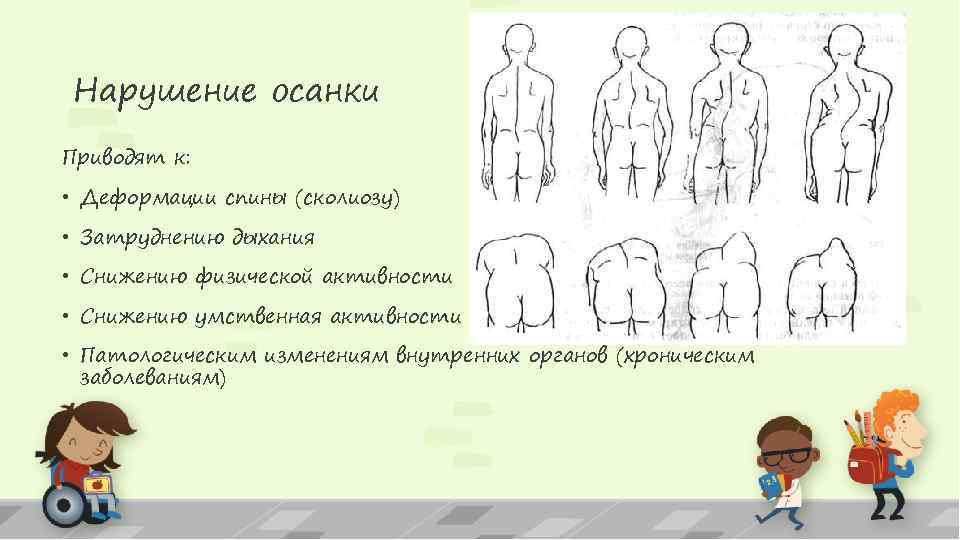 Нарушение осанки Приводят к: • Деформации спины (сколиозу) • Затруднению дыхания • Снижению физической