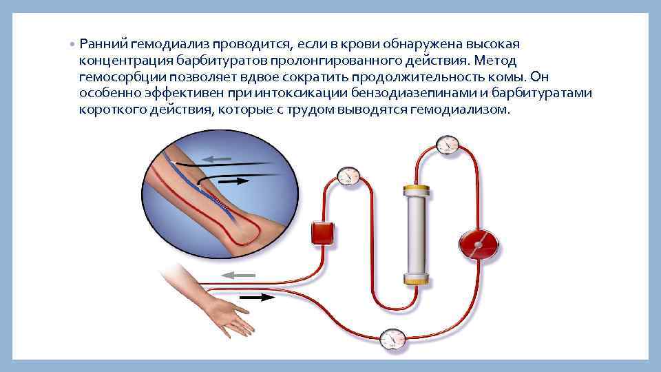  • Ранний гемодиализ проводится, если в крови обнаружена высокая концентрация барбитуратов пролонгированного действия.