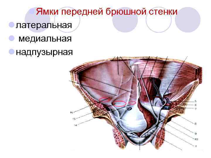 l Ямки передней брюшной стенки l латеральная l медиальная l надпузырная 