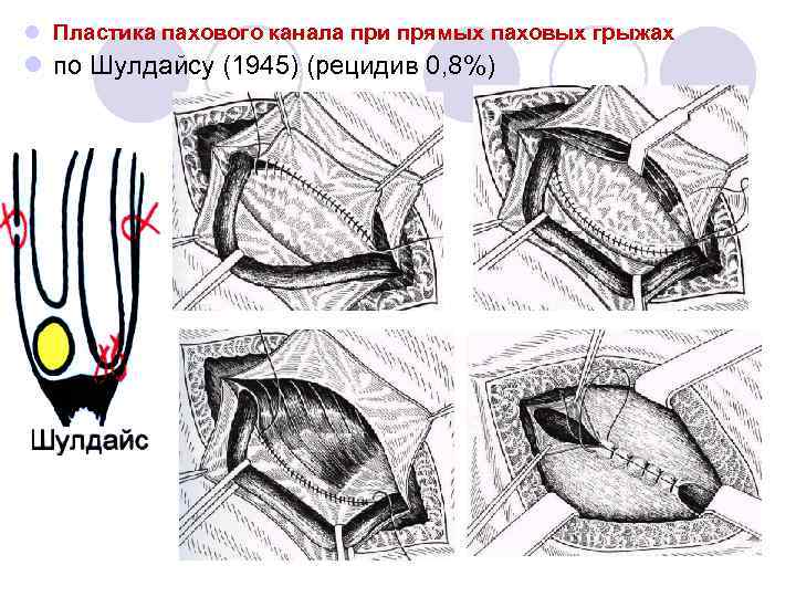 Обрезание у мужчин зачем