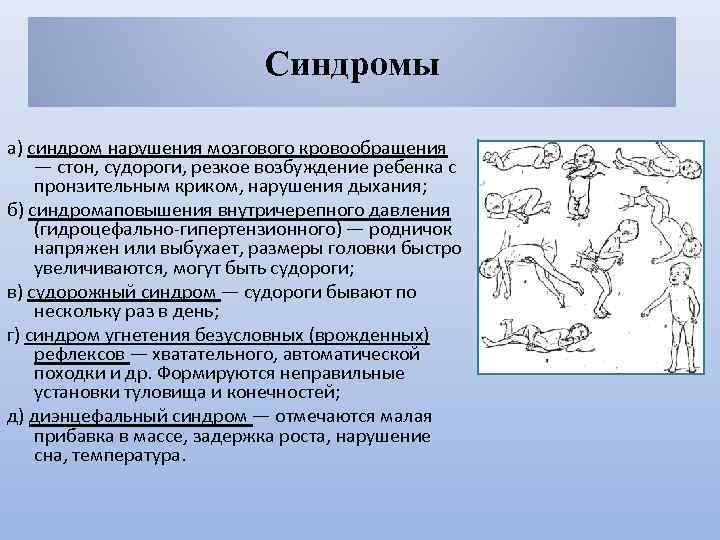 Синдромы а) синдром нарушения мозгового кровообращения — стон, судороги, резкое возбуждение ребенка с пронзительным