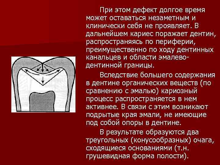 При этом дефект долгое время может оставаться незаметным и клинически себя не проявляет. В