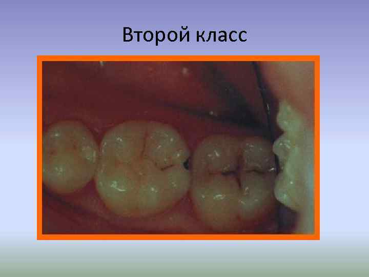 Второй класс 