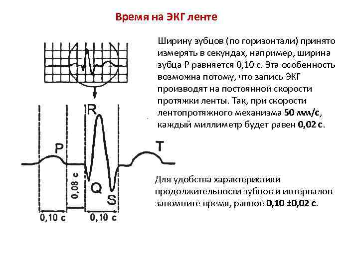 Время на ЭКГ ленте Ширину зубцов (по горизонтали) принято измерять в секундах, например, ширина