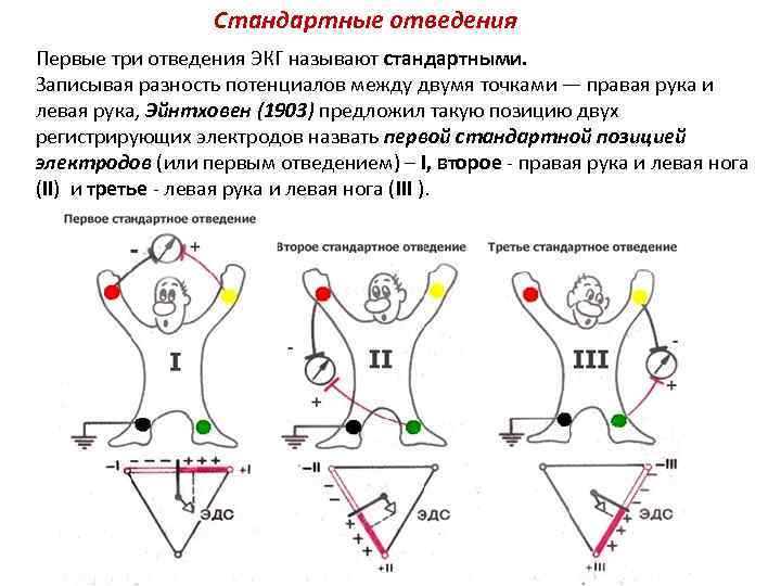 Cтандартные отведения Первые три отведения ЭКГ называют стандартными. Записывая разность потенциалов между двумя точками