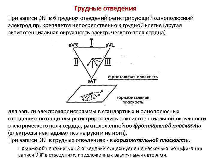 Электро диаграмма отражает электрическую активность