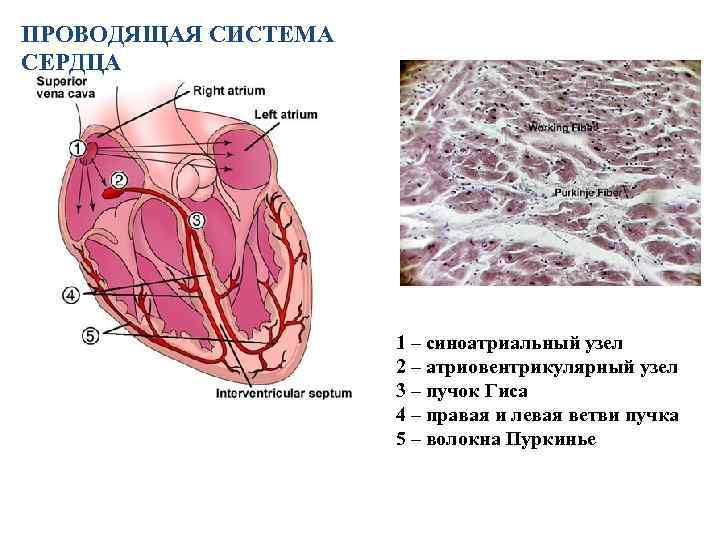 Пучок пуркинье. Волокна Пуркинье проводящей системы сердца. Строение проводящей системы сердца гистология. Проводящая система сердца гистология схема. Проводящая система сердца клетки гистология.