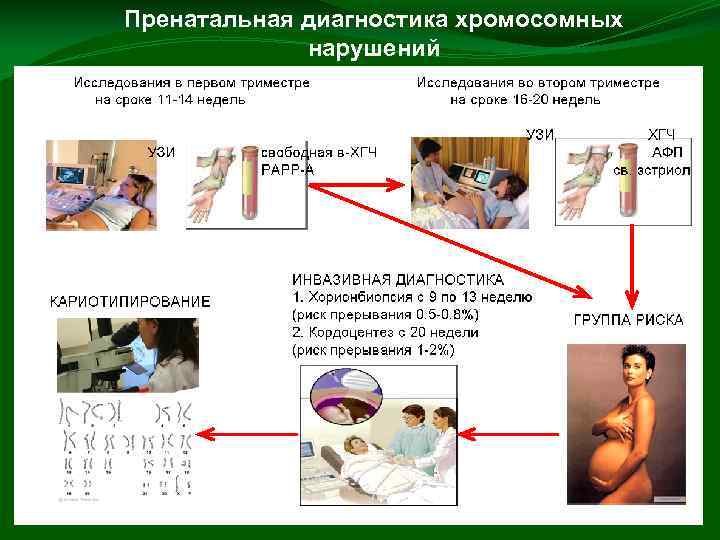 Пренатальная диагностика хромосомных нарушений 