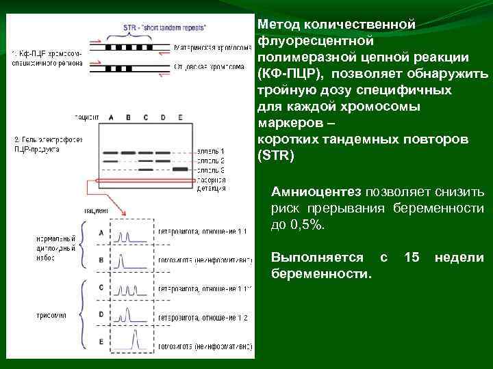 Метод количественной флуоресцентной полимеразной цепной реакции (КФ-ПЦР), позволяет обнаружить тройную дозу специфичных для каждой