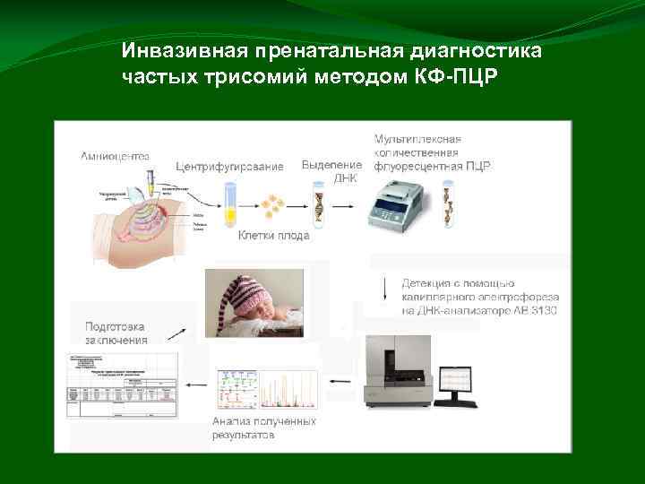 Инвазивная пренатальная диагностика частых трисомий методом КФ-ПЦР 