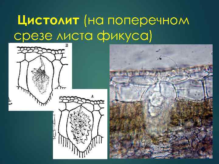  Цистолит (на поперечном срезе листа фикуса) 