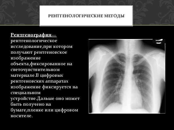 Описание и интерпретация рентгенографических изображений что это