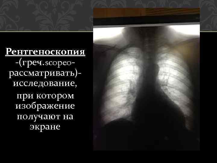 Рентгеноскопия -(греч. scopeoрассматривать)исследование, при котором изображение получают на экране 