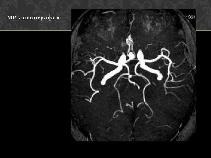 МР-ангиография 