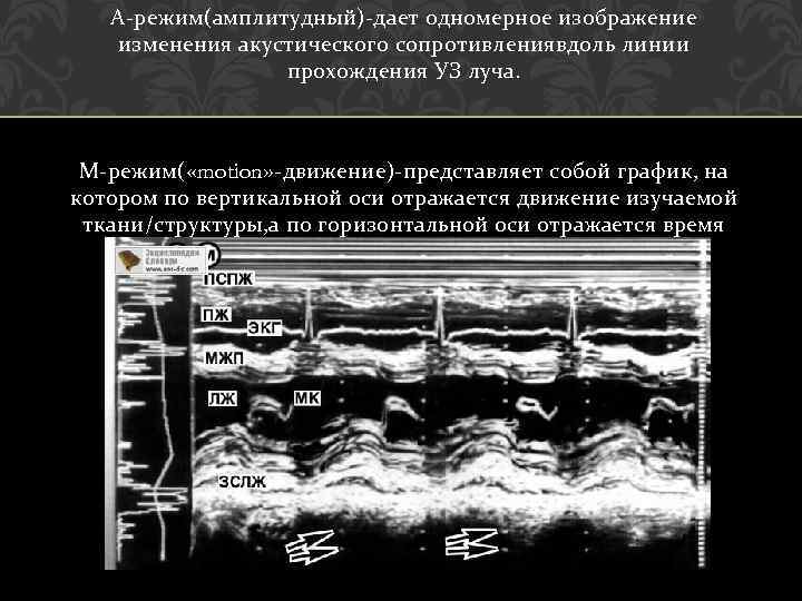 А-режим(амплитудный)-дает одномерное изображение изменения акустического сопротивлениявдоль линии прохождения УЗ луча. М-режим( «motion» -движение)-представляет собой