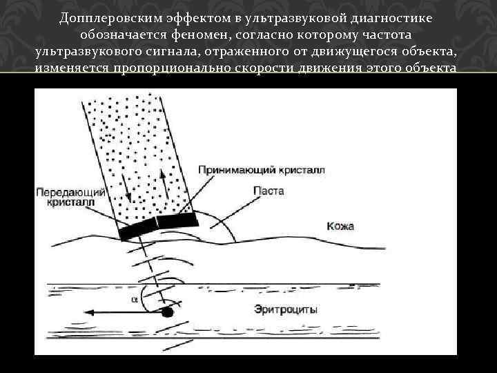 Допплеровским эффектом в ультразвуковой диагностике обозначается феномен, согласно которому частота ультразвукового сигнала, отраженного от