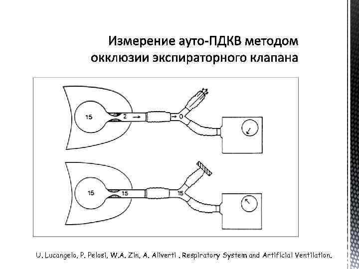 U. Lucangelo, P. Pelosi, W. A. Zin, A. Aliverti. Respiratory System and Artificial Ventilation.