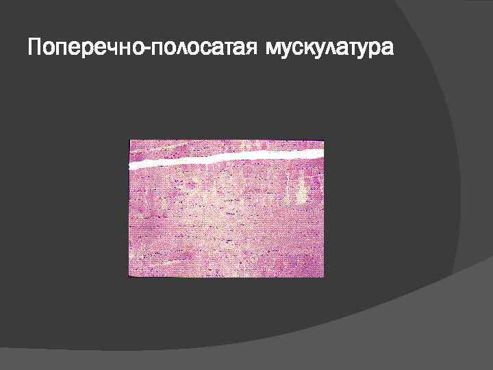 Поперечно-полосатая мускулатура 