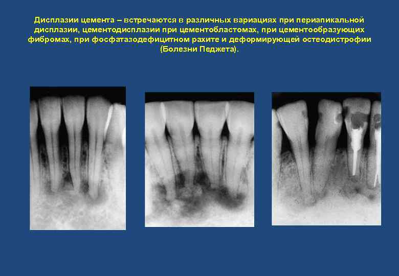 Наследственная остеодистрофия альбрехта презентация