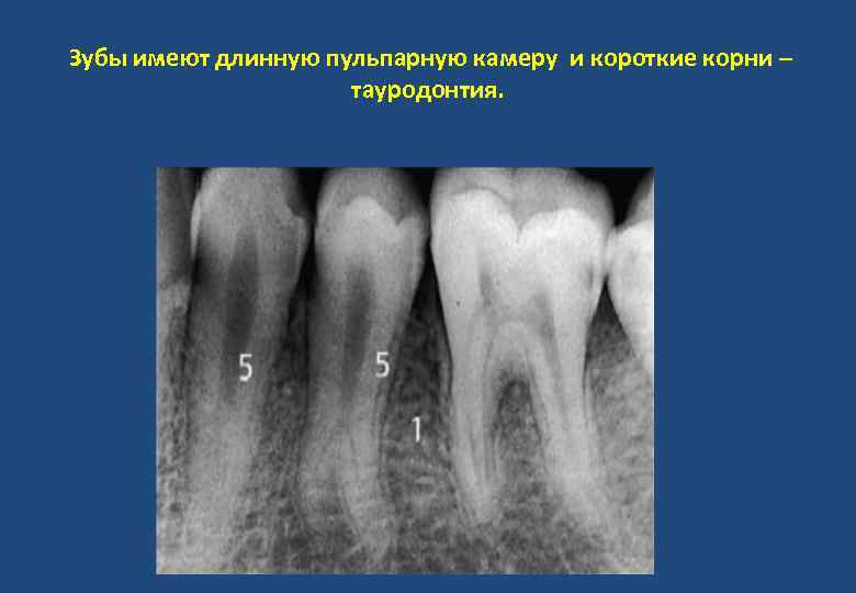 Зубы имеют длинную пульпарную камеру и короткие корни – тауродонтия. 