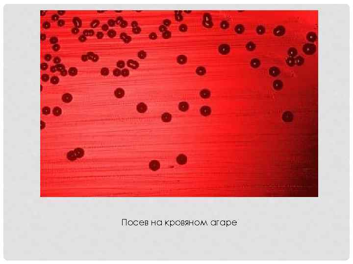 Посев на кровяном агаре 