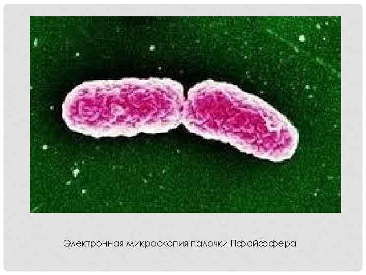 Электронная микроскопия палочки Пфайффера 