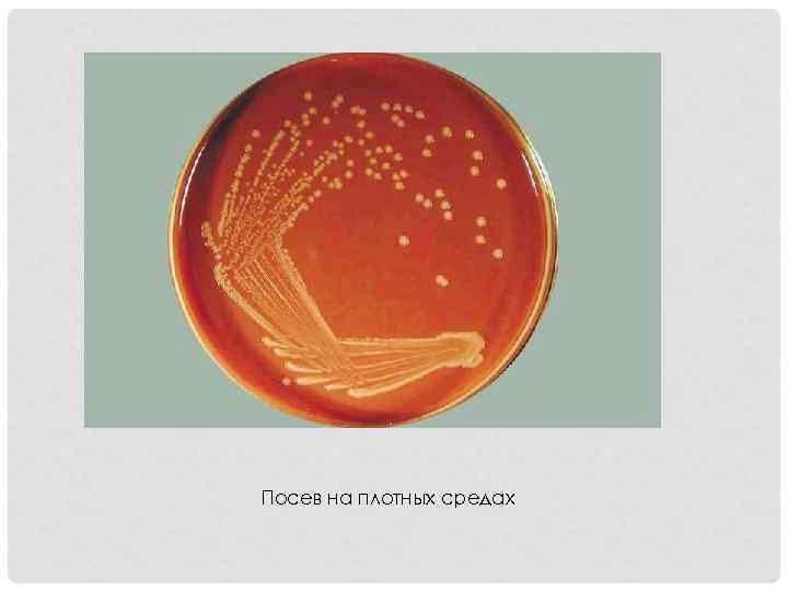 Посев на плотных средах 