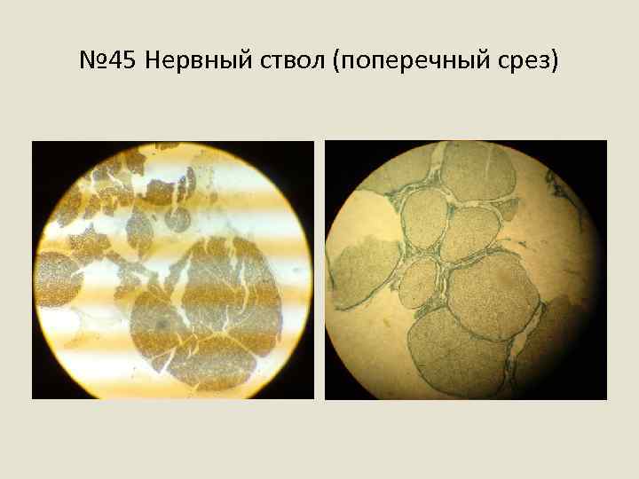 № 45 Нервный ствол (поперечный срез) 
