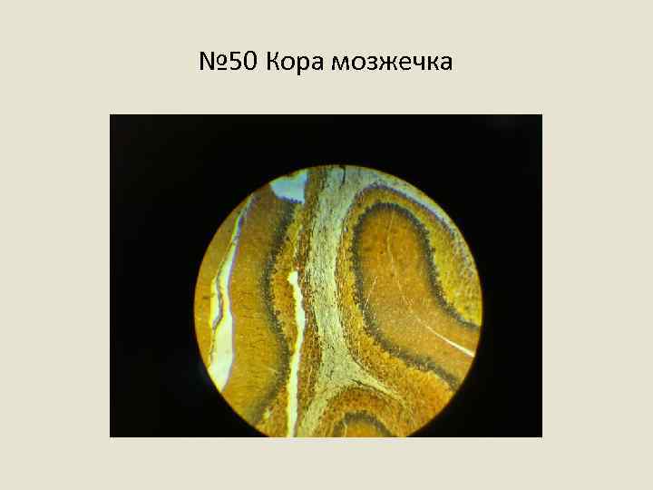 № 50 Кора мозжечка 