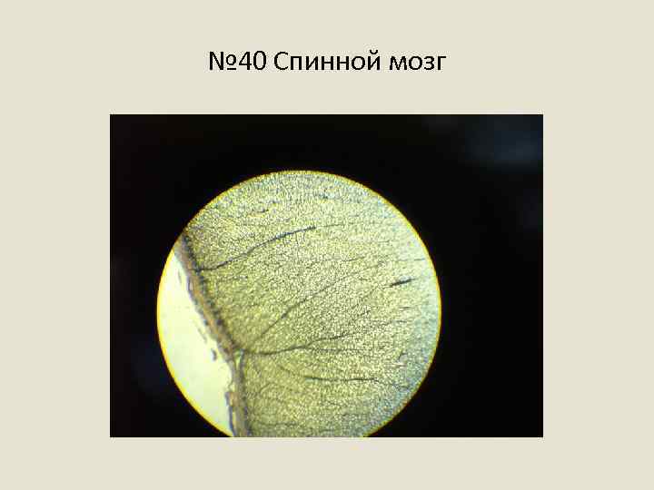 № 40 Спинной мозг 