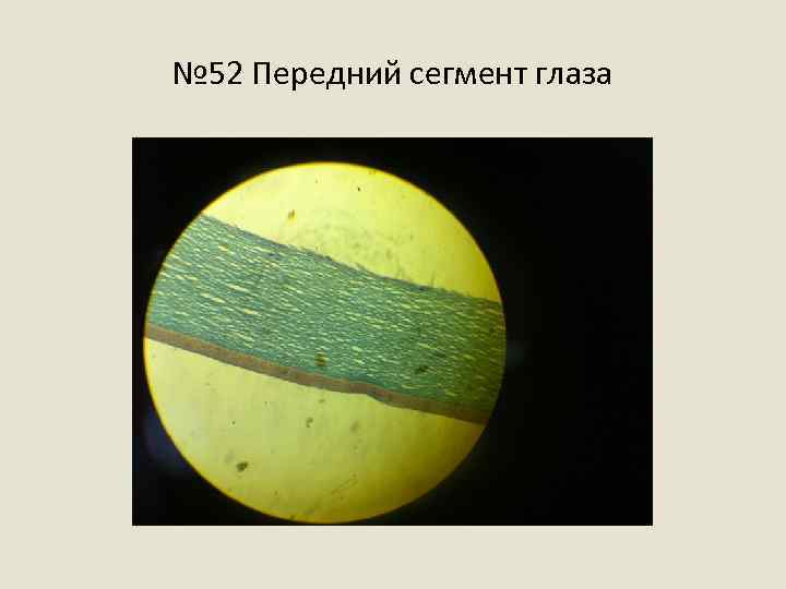 № 52 Передний сегмент глаза 