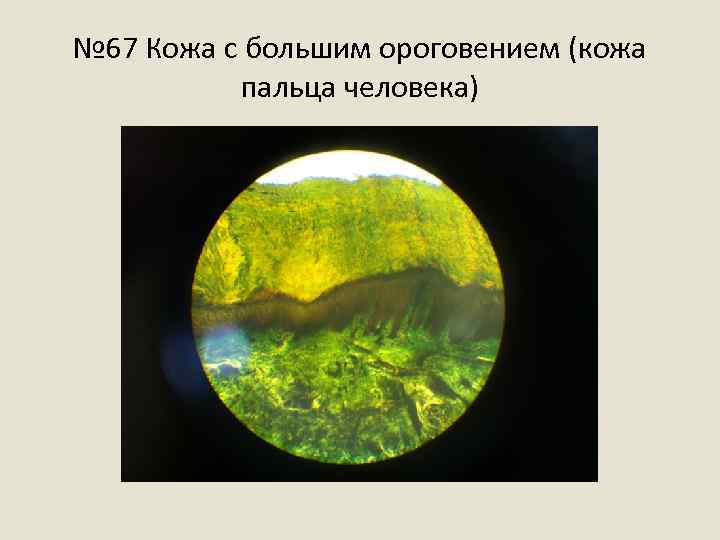 № 67 Кожа с большим ороговением (кожа пальца человека) 