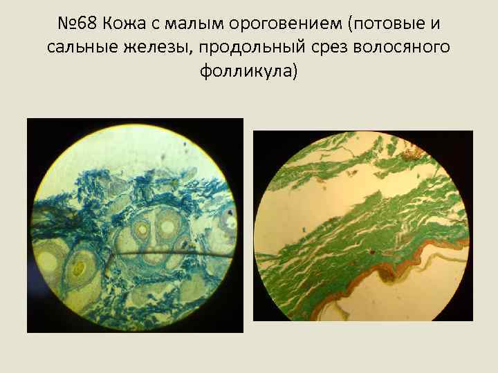 № 68 Кожа с малым ороговением (потовые и сальные железы, продольный срез волосяного фолликула)