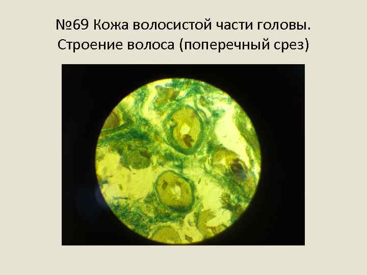 № 69 Кожа волосистой части головы. Строение волоса (поперечный срез) 
