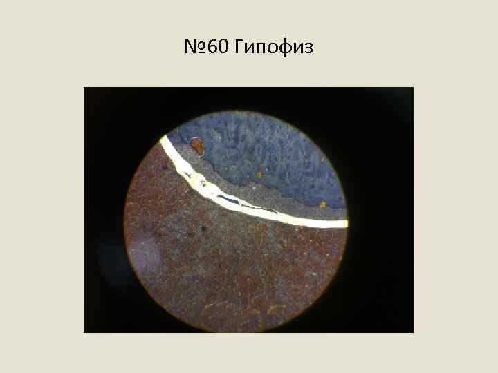 № 60 Гипофиз 