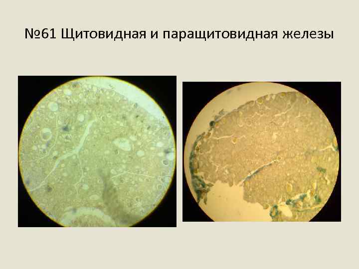 № 61 Щитовидная и паращитовидная железы 