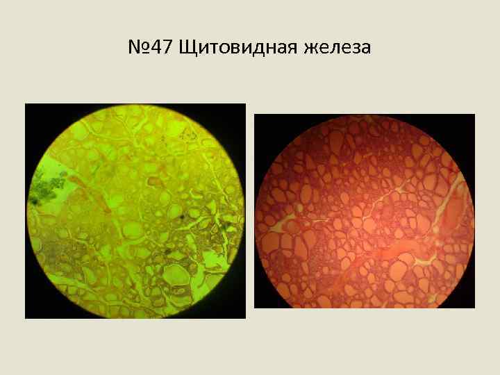 № 47 Щитовидная железа 