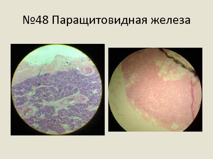 № 48 Паращитовидная железа 