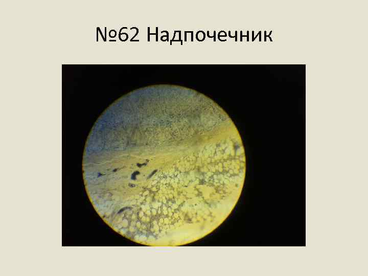 № 62 Надпочечник 