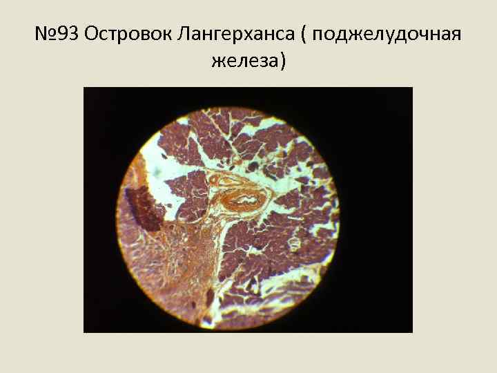 № 93 Островок Лангерханса ( поджелудочная железа) 