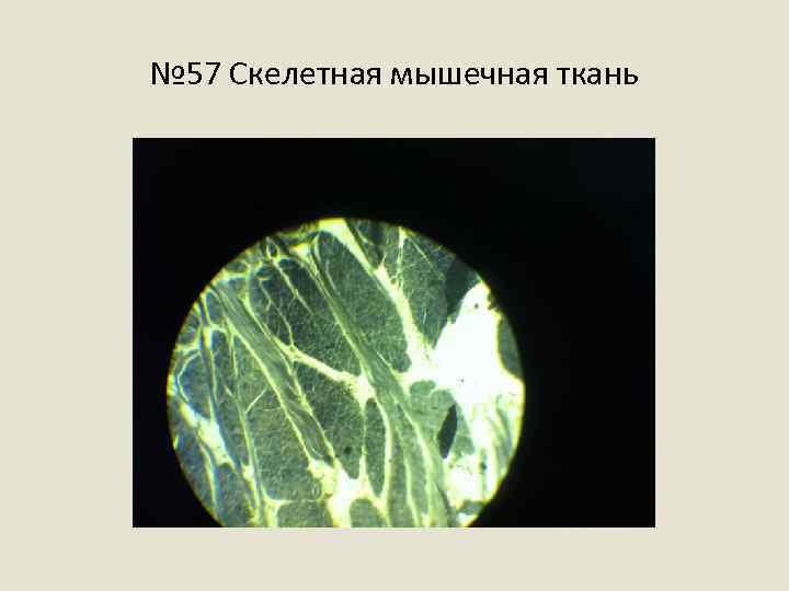 № 57 Скелетная мышечная ткань 